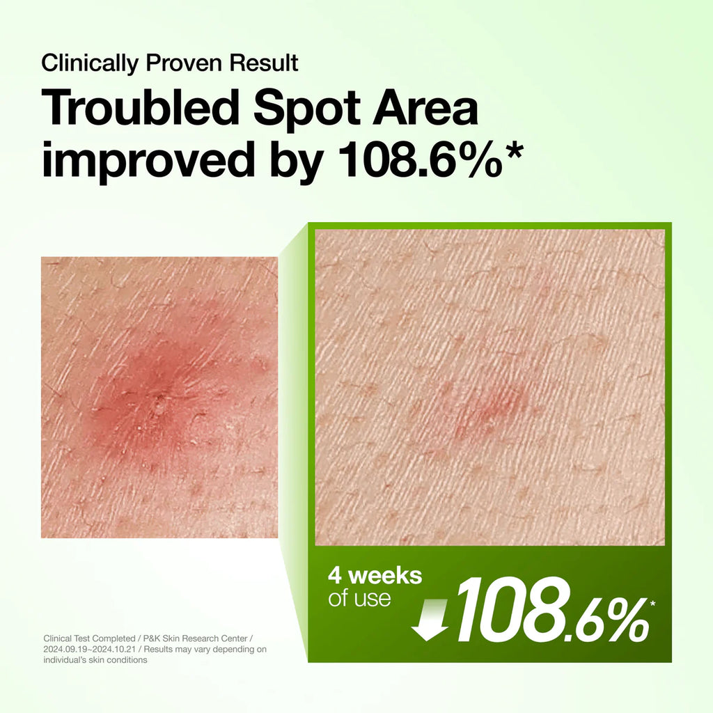 Anua Azelaic Acid 10 Hyaluron Redness Soothing Serum